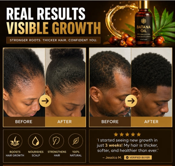 Nourish Your Roots | Honduran Batana Hair Oil